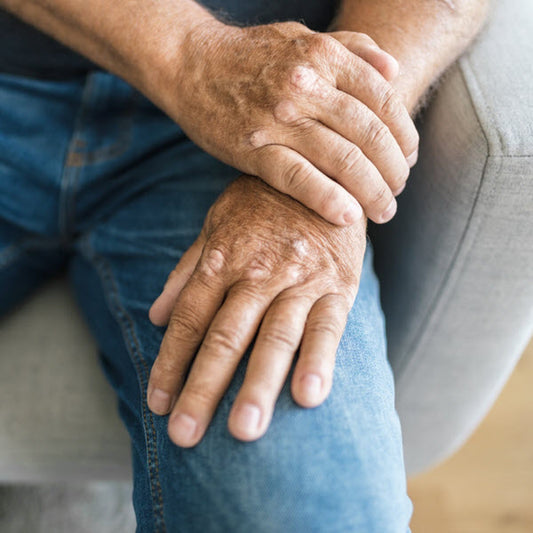 The 5 Types of Psoriatic Arthritis & How CBD Can Help